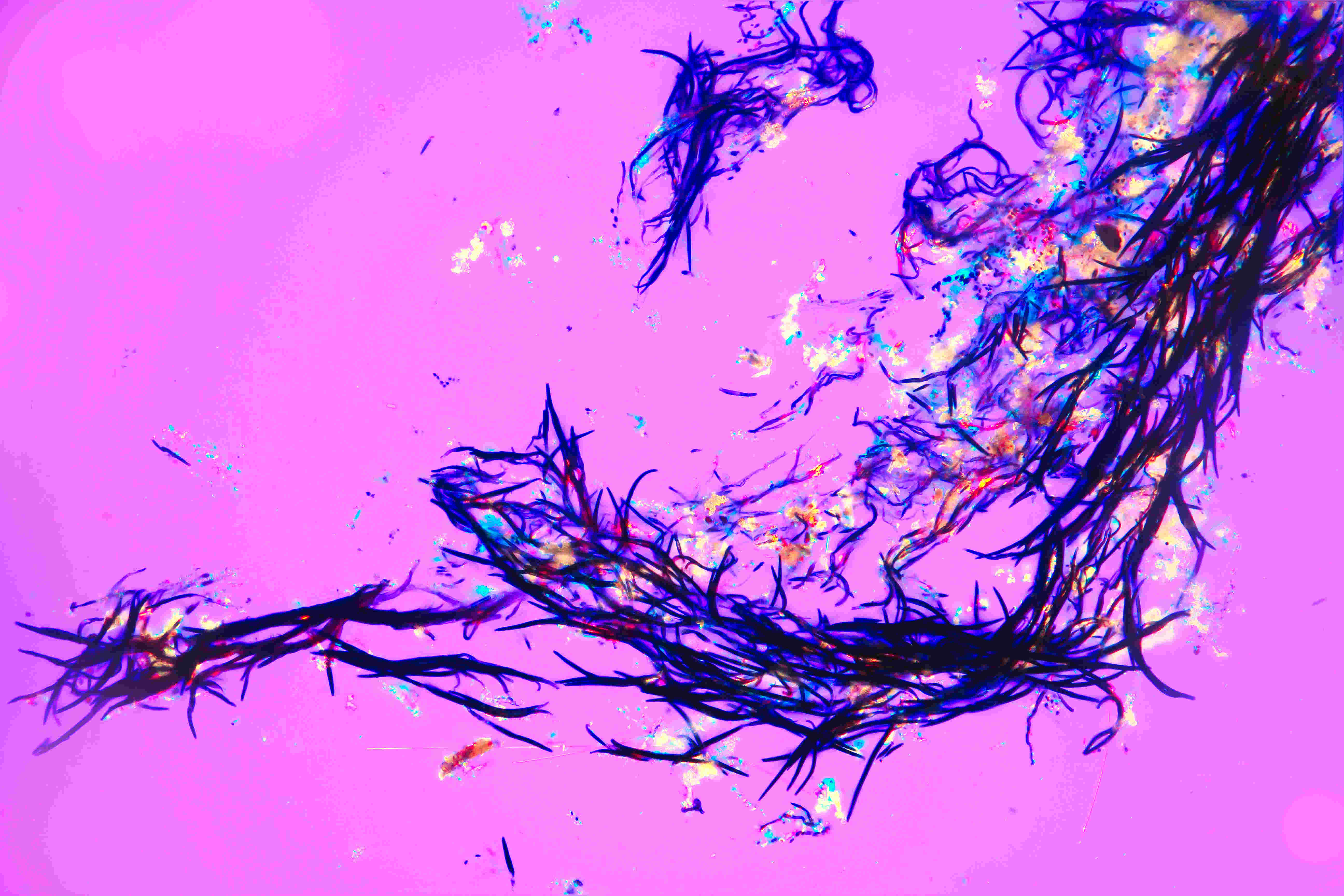 Silica Stories: Emmer Wheat at the Microscale